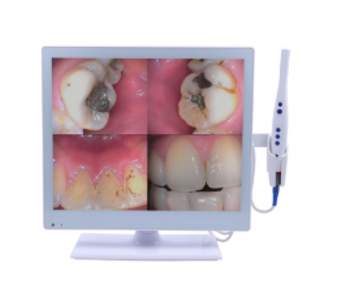 Intraoral Camera And Monitor